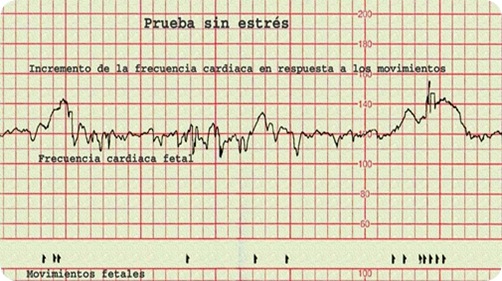 prueba sin estres_thumb[13]